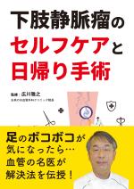 下肢静脈瘤のセルフケアと日帰り手術
